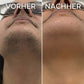 Pflanzlicher Haarwuchsstopp
