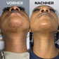 Pflanzlicher Haarwuchsstopp
