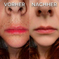 Pflanzlicher Haarwuchsstopp